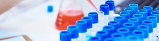 Protocol: CRISPR Knockoout Cell Line Protocol (Part 1): gRN